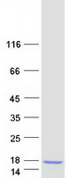 Coomassie blue staining of purified PPBP protein