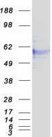 protp02790 hemopexin hpx human recombinant protein