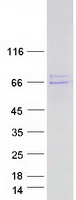 protp03372 estrogen receptor 1 esr1 human recombinant protein
