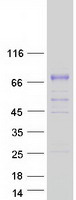protp03952 plasma kallikrein 1b klkb1 human recombinant protein