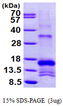 3ug by SDS-PAGE under reducing condition and visualized by coomassie blue stain.