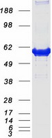 Coomassie blue staining of purified CAT protein