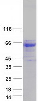 protp04062 gba human recombinant protein