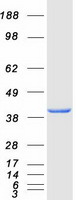 Coomassie blue staining of purified ALDOA protein