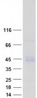 Coomassie blue staining of purified PDGFA protein