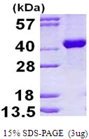 3ug by SDS-PAGE under reducing condition and visualized by coomassie blue stain.