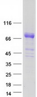 Coomassie blue staining of purified SERPING1 protein
