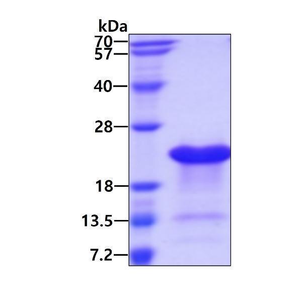 protp06454 sdspage human ptma recombinant protein_1