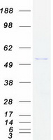 protp07099 epoxide hydrolase ephx1 human recombinant protein