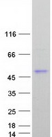 protp07585 decorin dcn human recombinant protein