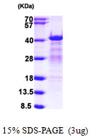 3ug by SDS-PAGE under reducing condition and visualized by coomassie blue stain.