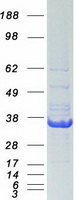 Coomassie blue staining of purified ERCC1 protein