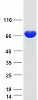 Coomassie blue staining of purified ANXA6 protein
