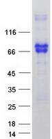 protp08138 p75 ngf receptor ngfr human recombinant protein