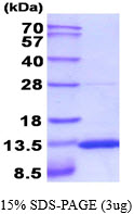 3ug by SDS-PAGE under reducing condition and visualized by coomassie blue stain.