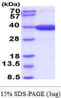 3ug by SDS-PAGE under reducing condition and visualized by coomassie blue stain.