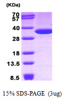 3ug by SDS-PAGE under reducing condition and visualized by coomassie blue stain