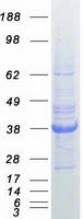 Coomassie blue staining of purified SPARC protein
