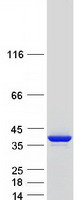 protp09493 tpm1 human recombinant protein