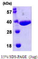 3ug by SDS-PAGE under reducing condition and visualized by coomassie blue stain