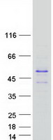 Coomassie blue staining of purified TSPY3 protein
