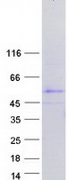 protp0cv99 tspy4 human recombinant protein