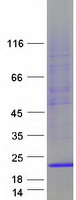 Coomassie blue staining of purified TRAPPC2 protein