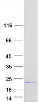 Coomassie blue staining of purified TRAPPC2B protein