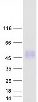 protp0dkb5 tpbgl human recombinant protein