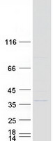 Coomassie blue staining of purified SULT1A3 protein
