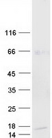 protp0dte7 salivary alpha amylase amy1b human recombinant protein