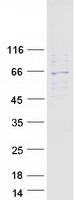 Coomassie blue staining of purified RO60 protein