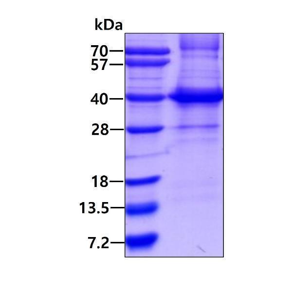 3ug by SDS-PAGE under reducing condition and visualized by coomassie blue stain