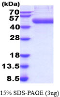 3ug by SDS-PAGE under reducing condition and visualized by coomassie blue stain.