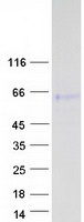 Coomassie blue staining of purified CLU protein