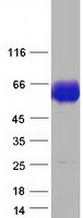 protp11117 acid phosphatase 2 acp2 human recombinant protein