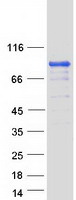 protp11171 epb41 human recombinant protein