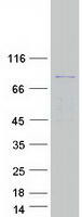 protp11217 pygm human recombinant protein