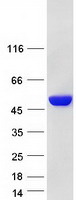 protp11413 g6pd human recombinant protein