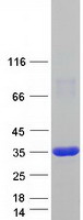 Coomassie blue staining of purified PRPS2 protein