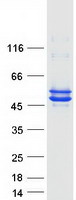 Coomassie blue staining of purified CKMT1B protein