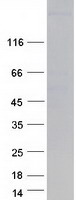 protp13533 asd3 myh6 human recombinant protein