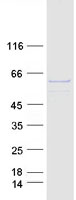 Coomassie blue staining of purified P4HA1 protein