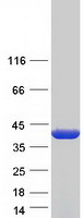 Coomassie blue staining of purified ALAD protein