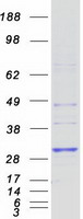 Coomassie blue staining of purified HLA-DRB4 protein