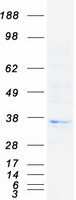 protp13765 hla dob hla dob human recombinant protein