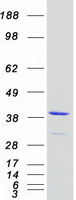 protp13805 troponin t1 tnnt1 human recombinant protein