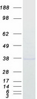 protp13995 mthfd2 human recombinant protein