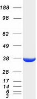 Coomassie blue staining of purified AKR1A1 protein