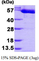 3ug by SDS-PAGE under reducing condition and visualized by coomassie blue stain.